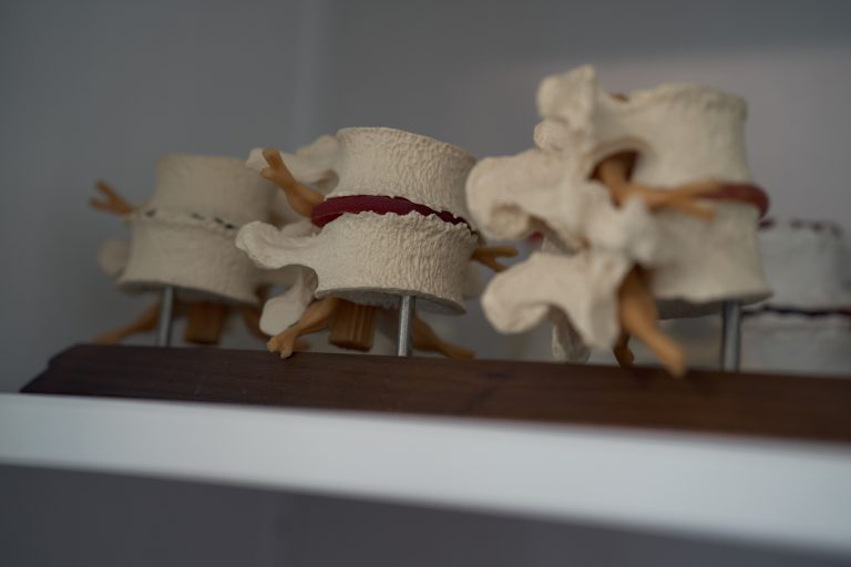 Is Only the Spine Being Treated?